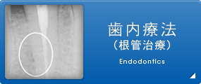 歯内療法 （根管治療） Endodontics