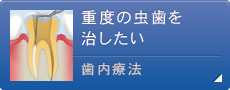 重度の虫歯を治したい  歯内療法