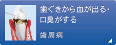 歯ぐきから血が出る・口臭がする 歯周病