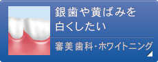 銀歯や黄ばみを白くしたい 審美歯科・ホワイトニング