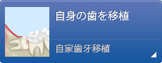 自身の歯を移植 自家歯牙移植