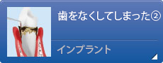 歯をなくしてしまった②インプラント