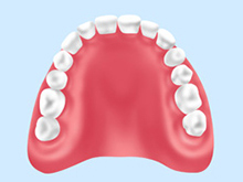 保険診療の入れ歯