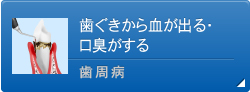 歯ぐきから血が出る・口臭がする 歯周病