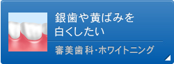 銀歯や黄ばみを白くしたい 審美歯科・ホワイトニング