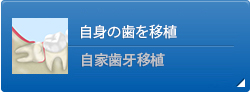 自身の歯を移植 自家歯牙移植