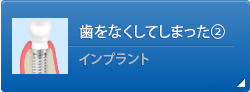 歯をなくしてしまった②インプラント