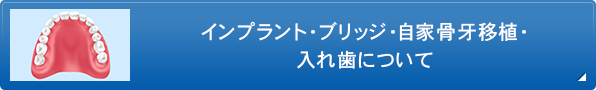 インプラント・ブリッジ・自家骨牙移植・入れ歯について