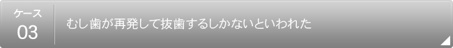 【ケース3】
                        むし歯が再発して抜歯するしかないといわれた